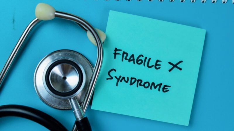 Síndrome do X Frágil: conheça as causas e os sintomas
