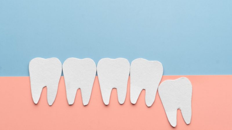 Dente do siso: por que algumas pessoas não têm?