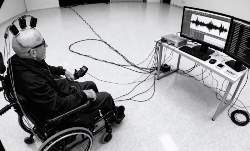 Implantes cerebrais permitem que homem paralisado componha músicas para banda punk