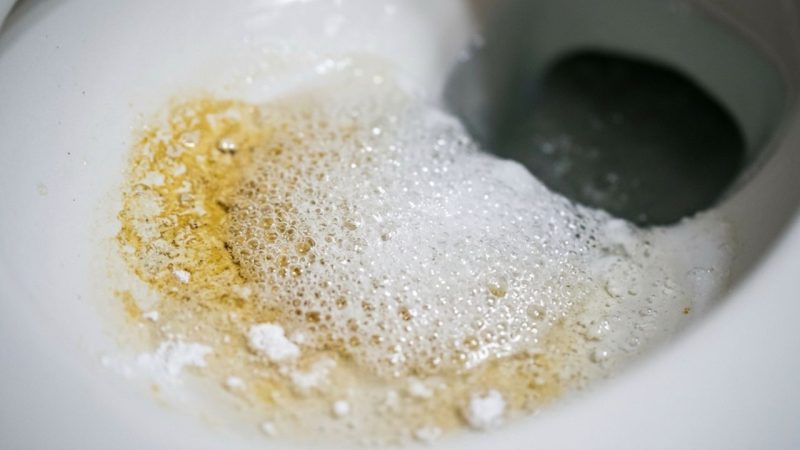 Como limpar o anel amarelo no fundo do vaso sanitário: veja como deixá-lo sem calcário e branco como no primeiro dia